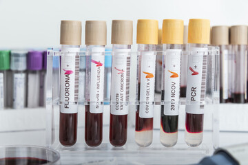 Blood samples of new variant OMICRON plus flu FLUORONE, covid19, coronavirus. Selective approach to...