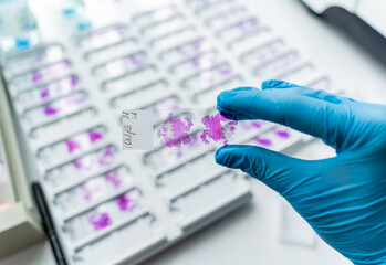 Hand in blue glove holding glass histology slides