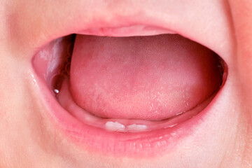 Teeth are teething at the infant baby, mouth close-up. Tongue and lower teeth incisors in a child at the age of six months