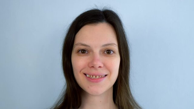 Portrait of woman with yellow bad teeth is smiling and looking at camera. Teeth sharpened by a dentist before installing crowns and ceramic veneers. Dentistry treatment, prosthetics of teeth concept.