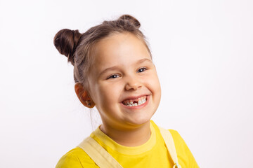 Portrait of shining little kid showing missing front baby tooth and smiling looking away in yellow t-shirt on white background. First teeth changing. Going to dentist to do tooth treatment. 