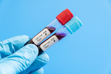 Carrier screening is a genetic test used to determine if a healthy person is a carrier of a recessive genetic disease.