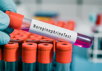 Adrenal glands Norepinephrine Test Maintains blood pressure