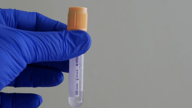 Blood collection container. Hand in blue nitrile glove. Empty test tube for human venous blood. Laboratory assistant holds transparent test tube. Healthcare professional receives blood for analysis
