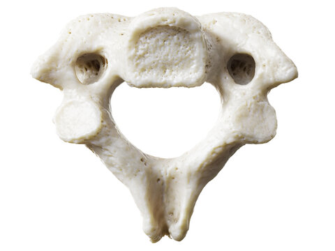 3d rendered illustration of the axis vertebrae