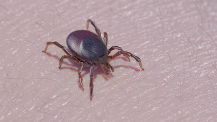 3d rendered illustration of a tick crawling on skin