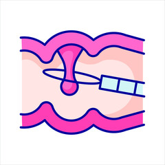 remove polyps, color icon, proctoscopy