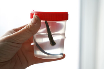 Hand holds medical leech for procedures in a jar in a laboratory