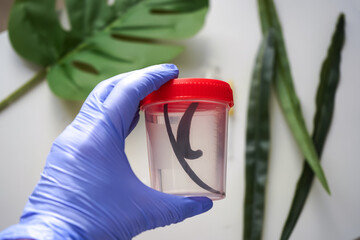Gloved hand holds medical leech for procedures in a jar in a laboratory
