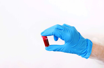 Doctor's hand holding test tube with blood sample for testing. blood test Concept. Doctor holding test glass tube with blood for covid-19 analyzing. Vertical photo 