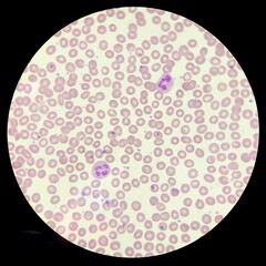 neutrophil
