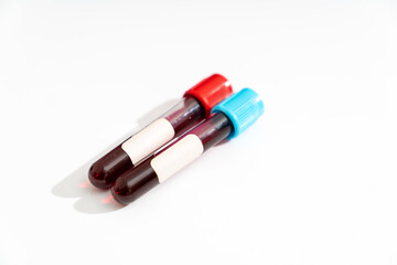 Two Test tube with empty label  to biological sample for medical laboratory research on white background
