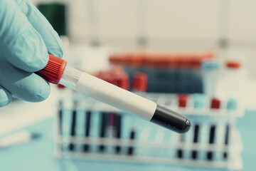 Test tube with empty label  to laboratory research