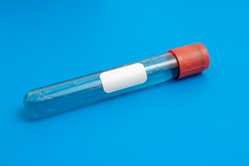 Test tube with empty label  to biological sample for medical laboratory research on blue background