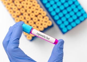 Legionella test result with blood sample in test tube on doctor hand in medical lab