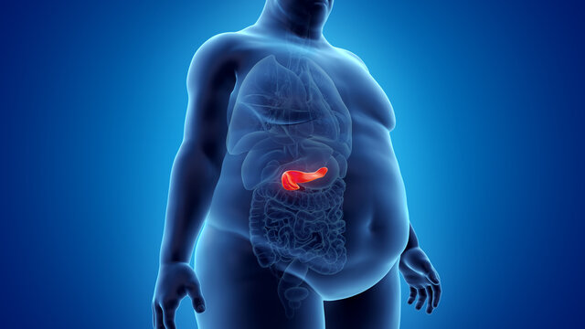 3d rendered illustration of an obese mans pancreas