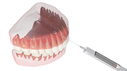 3d rendered illustration of dental anesthesia