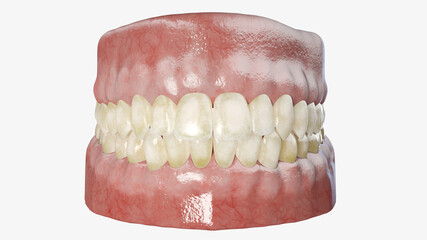 3d rendered illustration of dirty teeth