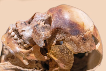 Skull
