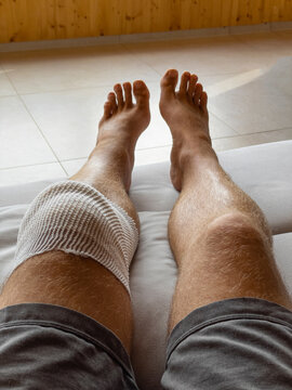 POV: Male Patient In Home Care After Knee Surgery Rests His Legs On The Couch.