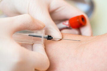 Doctor takes blood from a patient for analysis. Modern clinic with up to date equipment. Selective...
