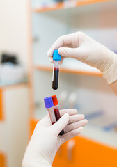 hand of doctor holding blood sample in tube test for analysis in laboratory. Stock photo
