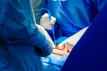 The hands of surgeons in sterile gloves operate with an electrocoagulator. Cutting the patient's skin with an electrocoagulator during surgery.