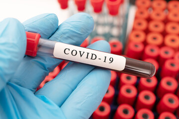 Hand holding a glass of test tube with patient's blood for testing covid-19