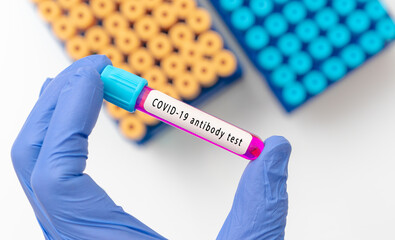 Obraz premium Covid antibody test with blood tubes