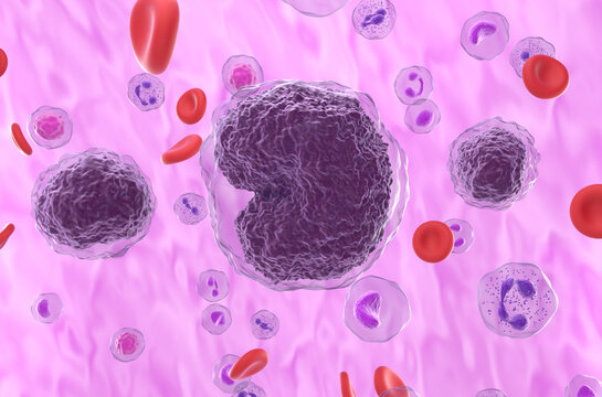Non-hodgkin lymphoma (NHL) cells in the blood flow - closeup view 3d illustration