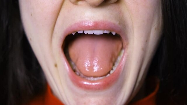 A woman with malocclusion and dysfunction of the temporomandibular joint opens and closes her mouth, the lower jaw shifts to the side.