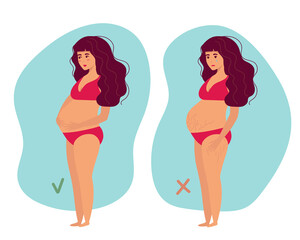 Pregnancy belly, stretch marks. Self love, body positive Motherhood. Preparation for childbirth. Vector illustration. For advertising, medical publications, for medicinal products, creams