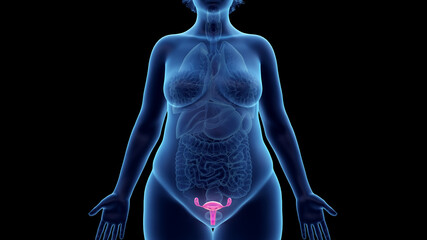 3d rendered illustration of an obese womans uterus