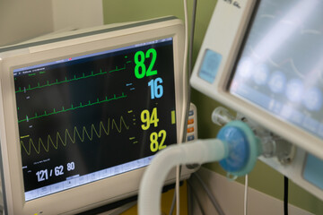 A bedside patient monitor surrounded by medical equipment of an intensive care unit. The screen is on and brightly shows patient parameters: oxygen saturation, ekg, blood pressure. 