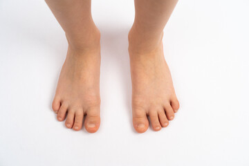 Fototapeta premium children's feet on a white background, the concept of prevention of children's flat feet, valgus of the foot