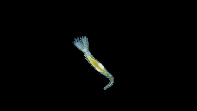 Polychaeta worm, order Sabellida under a microscope. Filters living in tubes of sand, shell fragments, glued together with mucus. Possibly family Fabriciidae. Indian Ocean