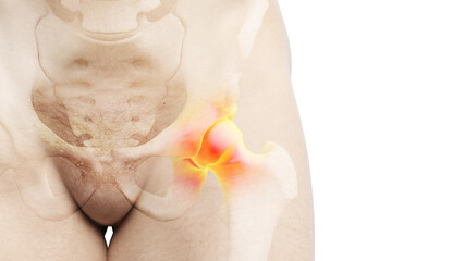 3d rendered illustration of a painful hip joint