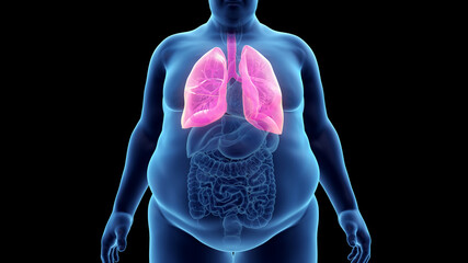 3d rendered illustration of an obese mans lung - obrazy, fototapety, plakaty