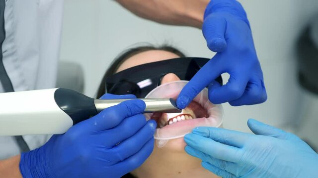 Dentist is doing intraoral scanning for woman before installing ceramic veneers and crowns. Orthodontist holds in his hand a manual 3D scanner for the jaw and mouth. Prosthodontics concept.