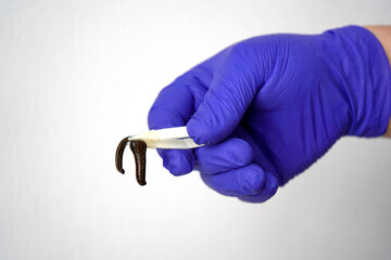 A gloved hand holds a leech in tweezers. Alternative treatment