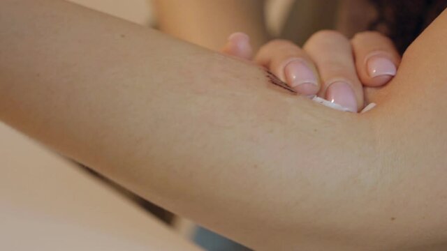 Women's hands remove the catheter from the vein after the injection, blood flows from the vein and a plaster is applied