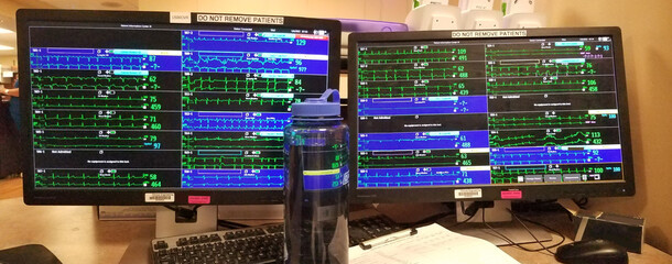 Multiple Green EKG Tracings on ICU Monitor