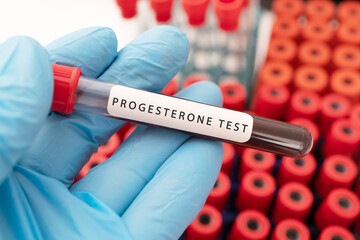 Hand holding a glass of test tube with patient's blood for testing progesterone  test