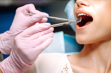 Young woman  at the dentist's chair during a dental procedure. Overview of dental caries prevention. Healthy teeth and medicine concept.
