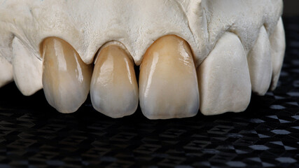 Three natural blossoms on the upper jaw model on a black background © Dental Pro Content