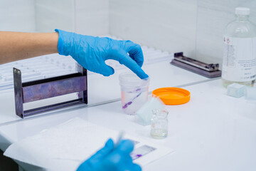 Hands in blue glove holding glass histology slides