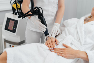 A young girl gets carbon peeling for the skin of her hands in a beauty salon. Laser pulses cleanse the skin. Hardware cosmetology. The process of photothermolysis, warming the skin.