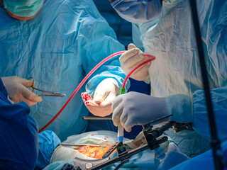 Close-up shot of gloved surgeons' hands pumping out blood with a catheter during surgery. Selective focus. Bloody hands of doctors in sterile gloves.