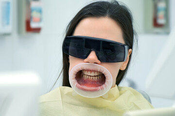 Woman in dentistry with retractor in her mouth and sunglasses waiting a doctor. Dental treatment....