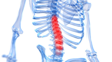 3d rendered illustration of a painful spine